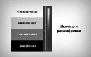 Эхоструктура печени неоднородная: причины, что значит, УЗИ-признаки
