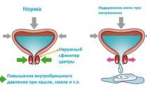 Мочеиспускание при кашле у женщин: лечение и упражнения 2019